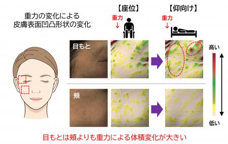 目もとは頬より重力による影響を受けやすい!~重力に 目もとは頬より重力による影響を受けやすい!~重力に