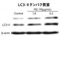 【研究成果】オートファジー研究を健康食品開発へ応用 【研究成果】オートファジー研究を健康食品開発へ応用