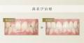 共立美容外科・歯科の「歯並び治療キャンペーンutf-8