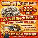 知らないと損？銀歯の買い取りをスタート